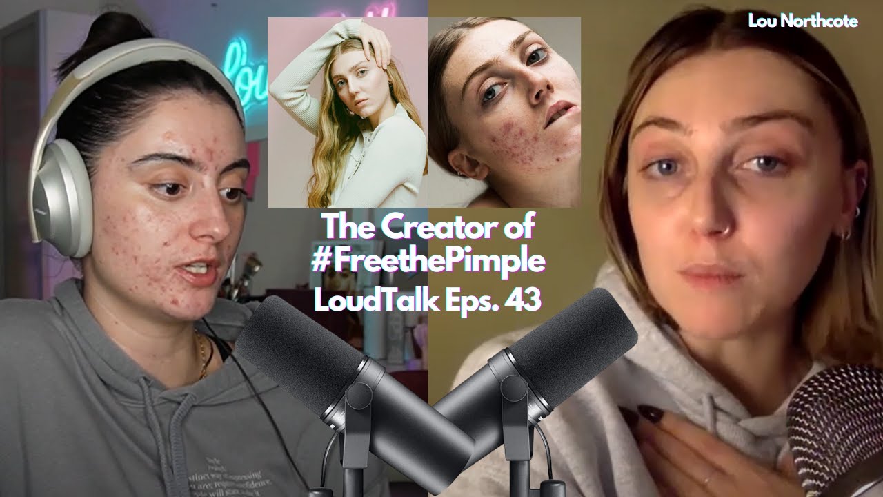 I Lost My Modelling Career Because of my Acne LoudTalk with Lou Northcote the #freethepimple creator