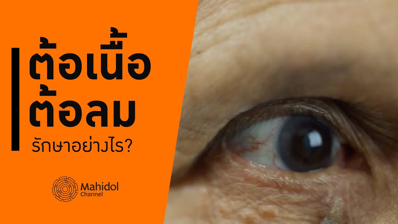 ต้อเนื้อ-ต้อลม รักษาอย่างไร? [หาหมอ by Mahidol Channel]