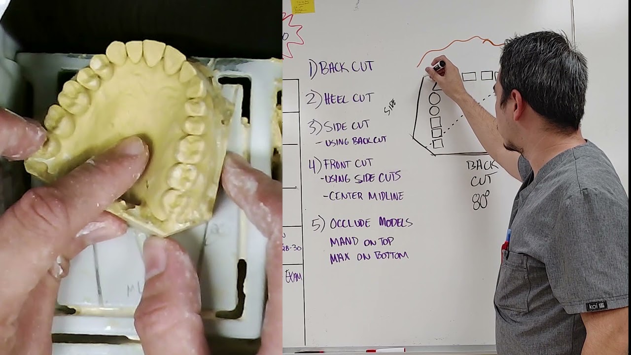 Trimming Study Models - Study, Bleach, and Retainer Casts