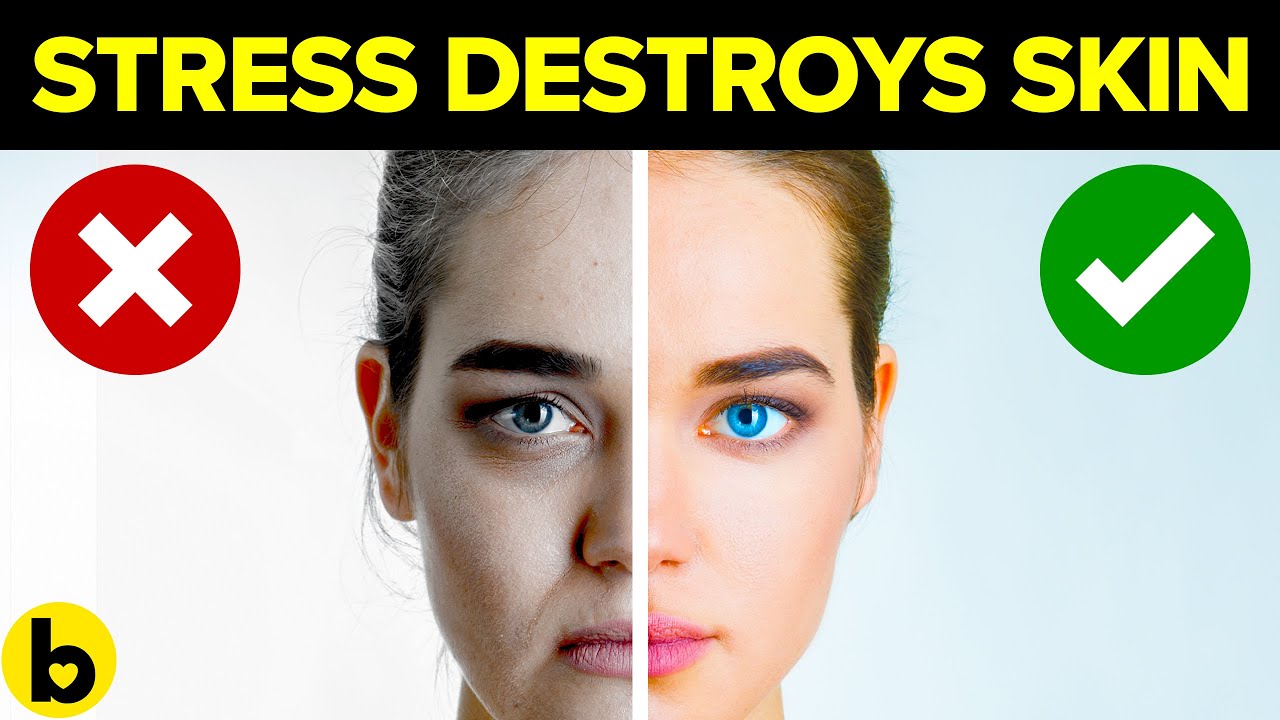 9 Reasons Why Stress Is Bad For Your Skin & How To Stop It