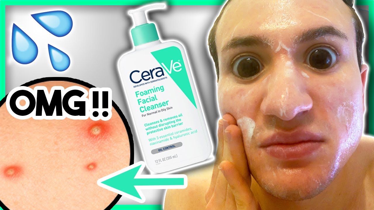 I used CeraVe Foaming Facial Cleanser for ONE WEEK!! (it broke me out?!)