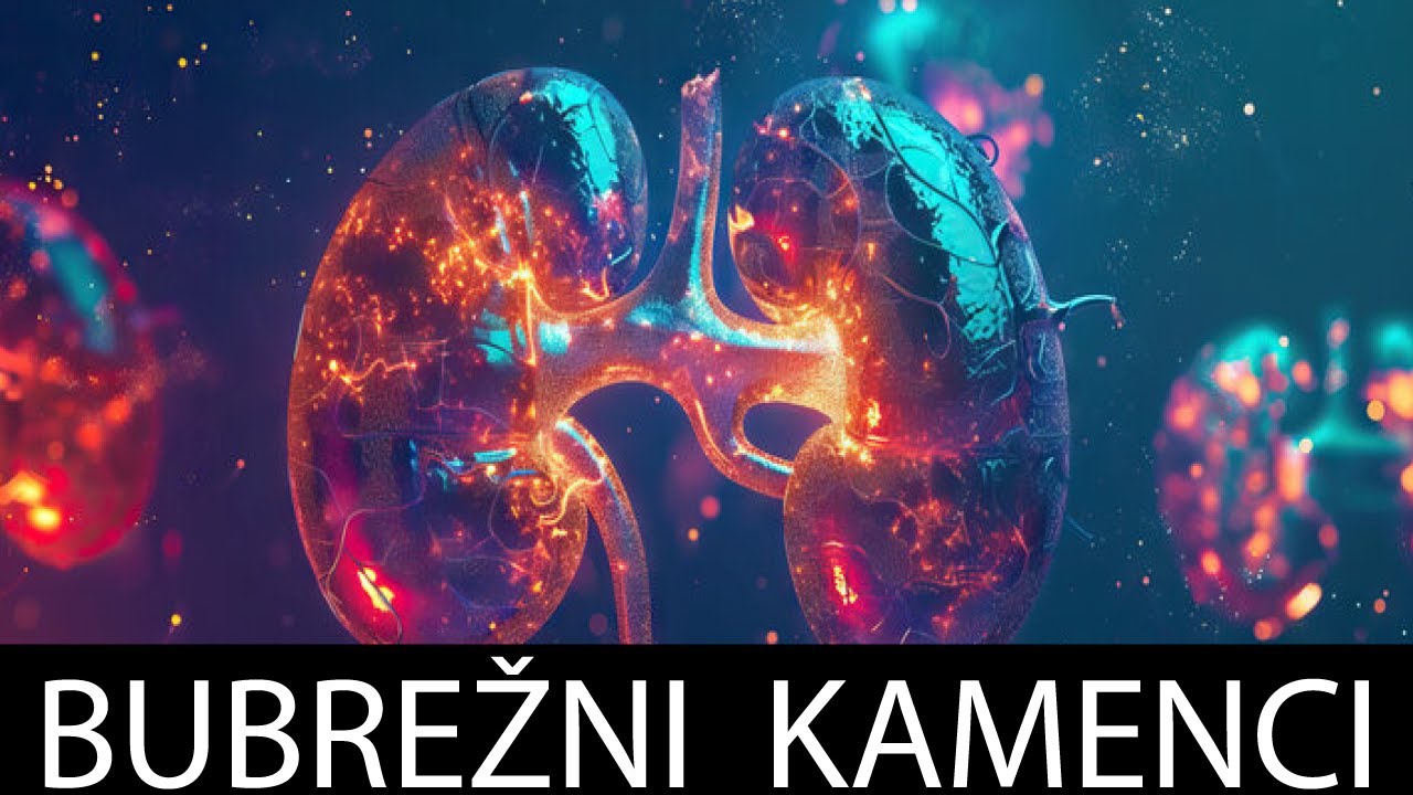 Bubrežni Kamenci: Ključne Stvari Koje Svi Moraju Znati! Dr#146