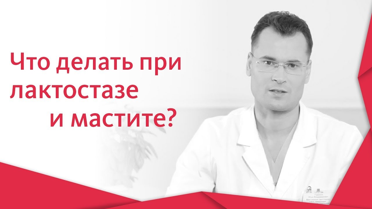 🍼 Как не допустить развития лактостаза и мастита во время кормления грудью. Лактостаз и мастит. 12+
