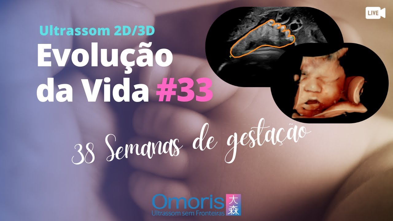 Gravidez 38 semanas - Imagens do exame em 4D - Evolu&ccedil;&atilde;o da Vida #33