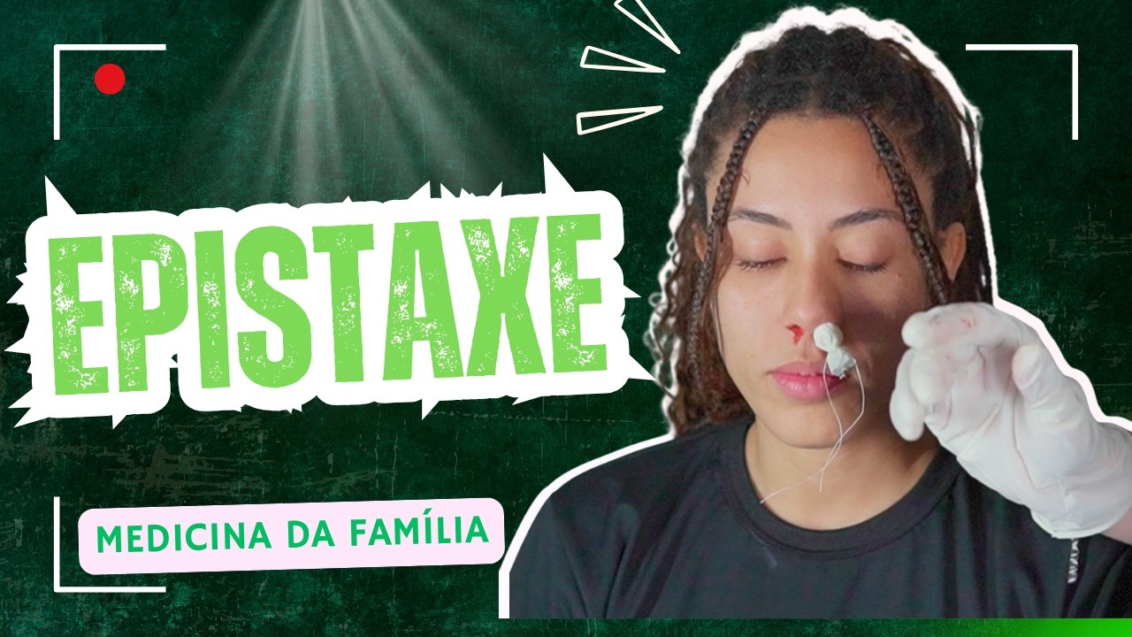 Epistaxe | Abordagem médica rápida e segura