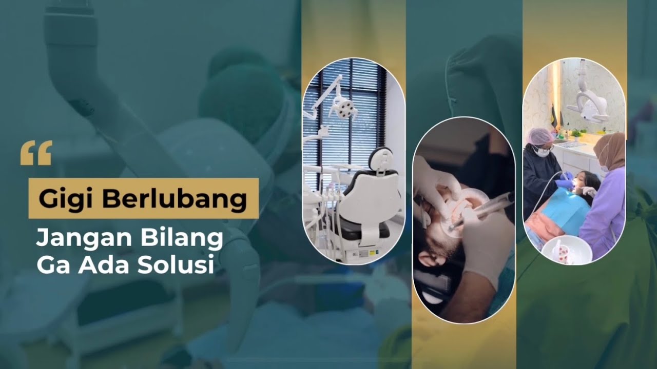 Gigi Berlubang - Cabut atau Rawat? Jangan Bilang Gak Ada Solusi!