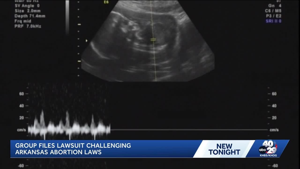 Fort Smith woman part of new lawsuit challenging Arkansas' near-total abortion ban
