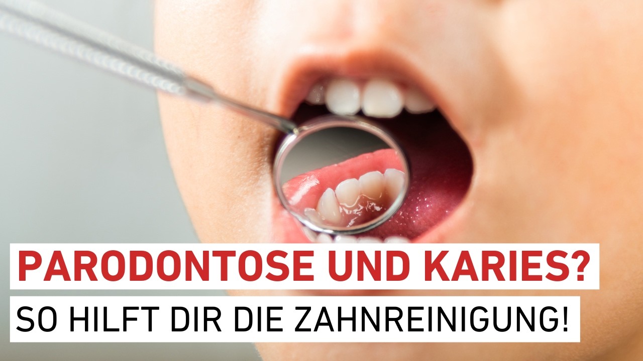 Zahnreinigung: Der Schl&uuml;ssel zu gesunden Z&auml;hnen!