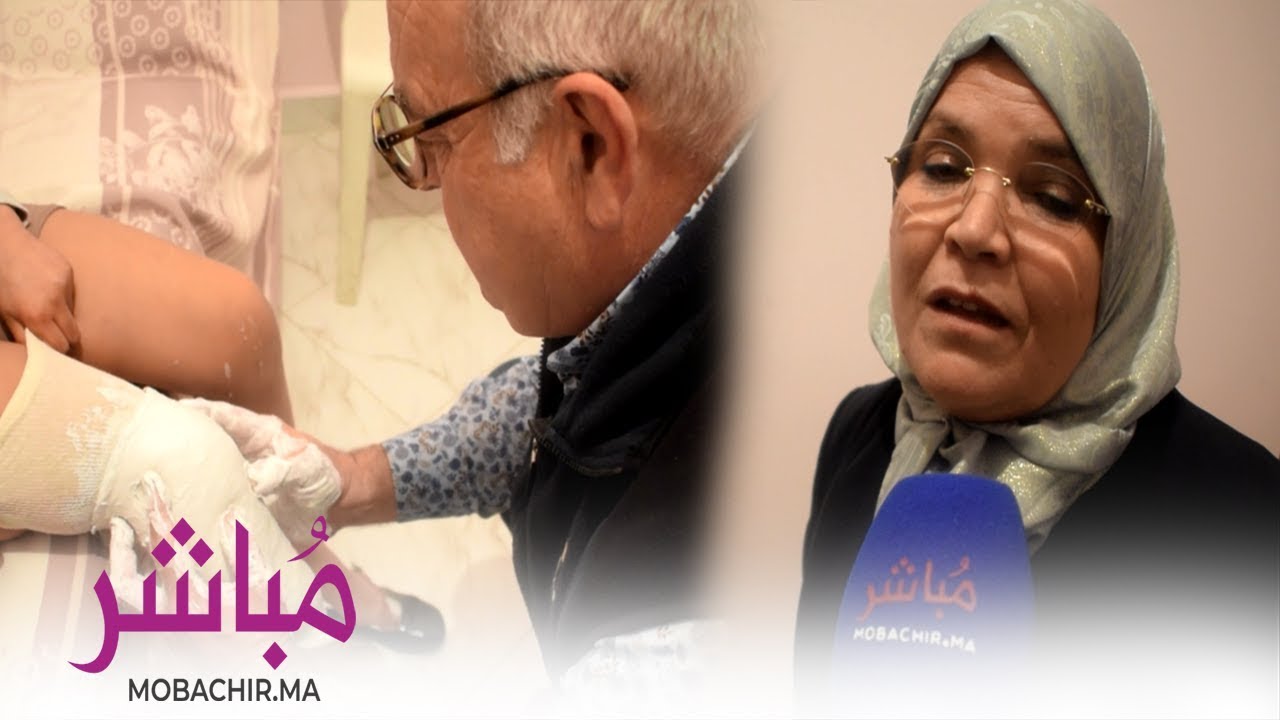 جمعية خيرية بطنجة توفر الأطراف الصناعية بالمجان لذوي اللإعاقات
