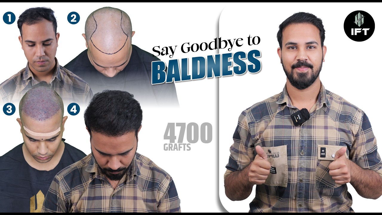 IFT Hair Science: Best Hair Transplant in Chandigarh | Cost & Results