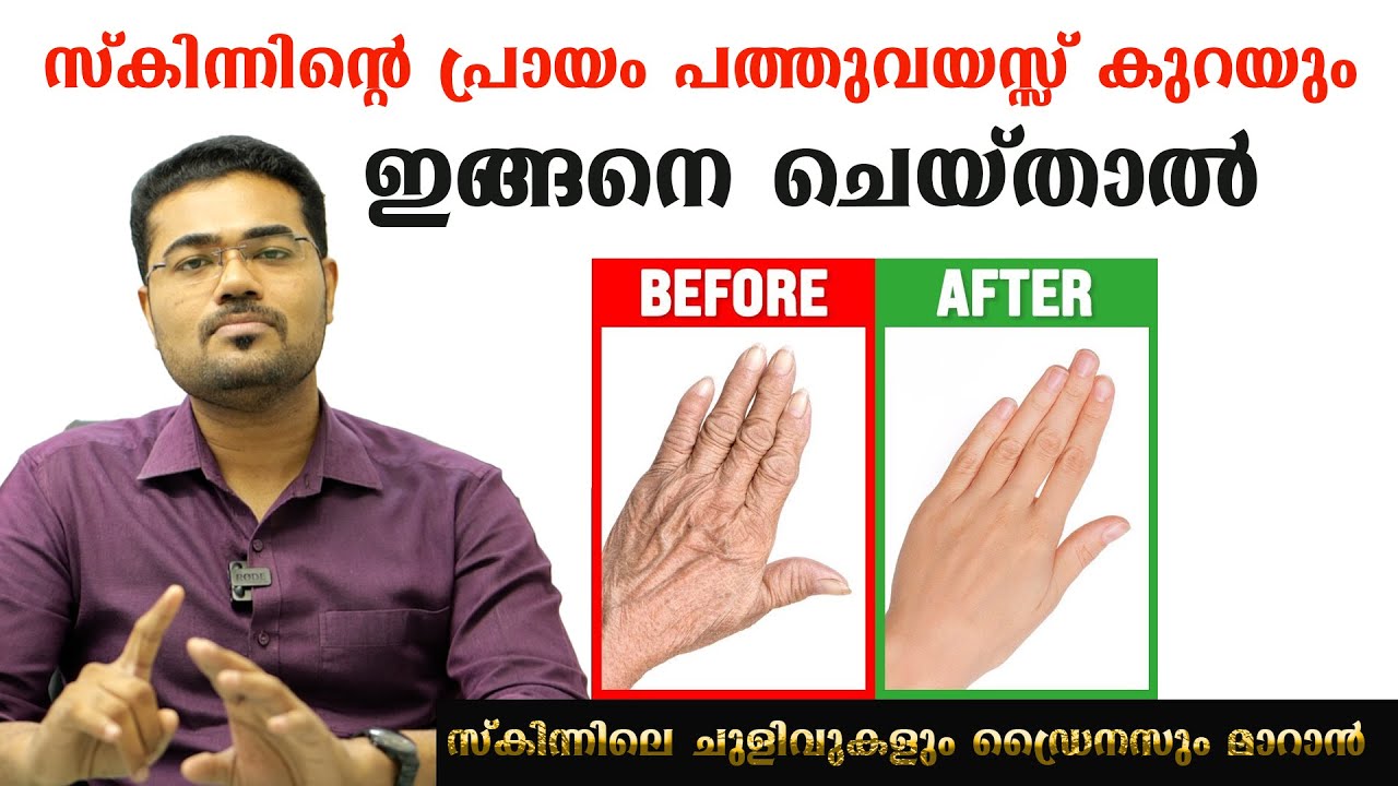 സ്കിന്നിന്റെ പ്രായം പത്തുവയസ്സ് കുറയും ഇങ്ങനെ ചെയ്താൽ /Dr Manoj Johnson
