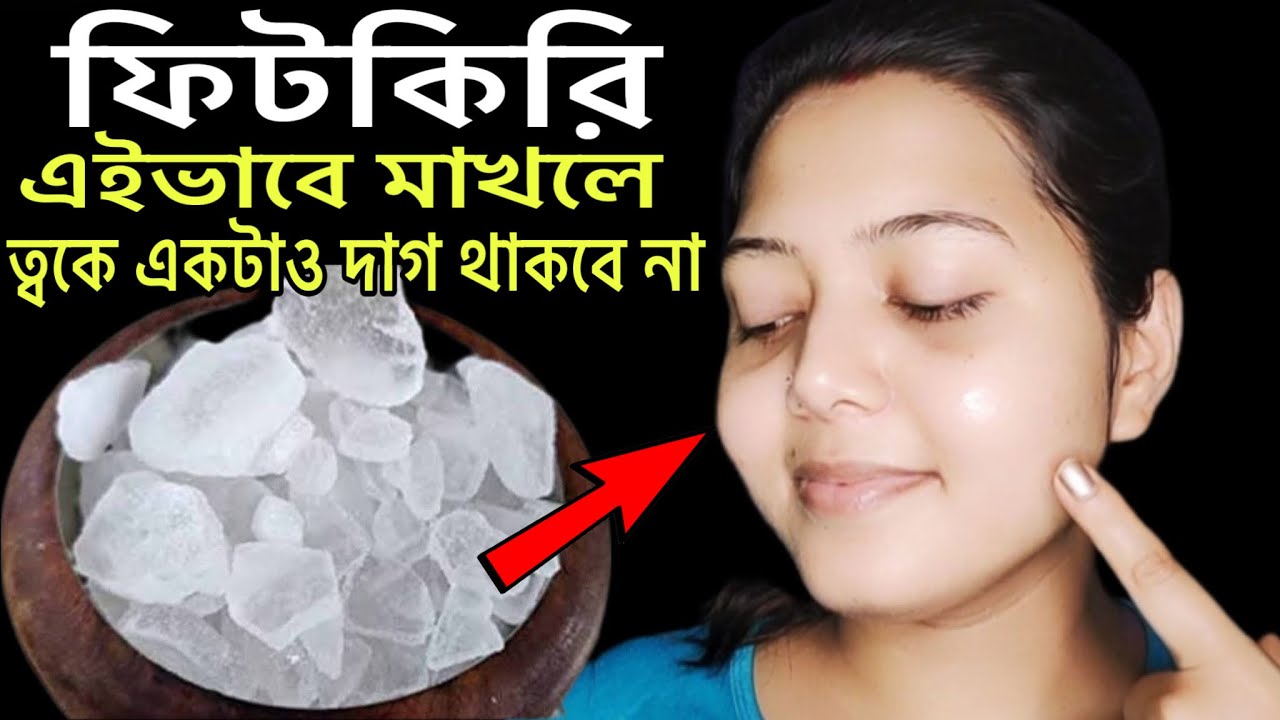 ফিটকিরি মুখে এইভাবে মাখলে ত্বকে একটাও দাগ থাকবে না/mukhar kalo dag dur korar upay/Skin Whitening