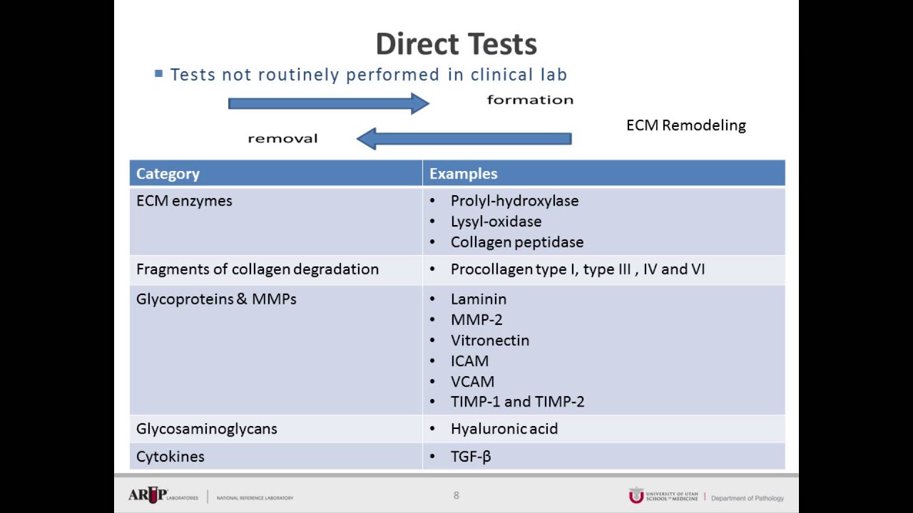 AACC 2015 Booth Presentation: Non-Invasive Assessment of Liver Fibrosis