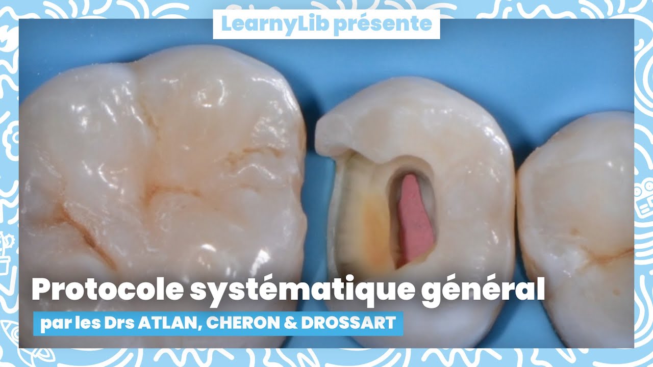 🦷 Inlays, Onlays : le protocole systématique général de préparation avec le Dr Maxime DROSSART