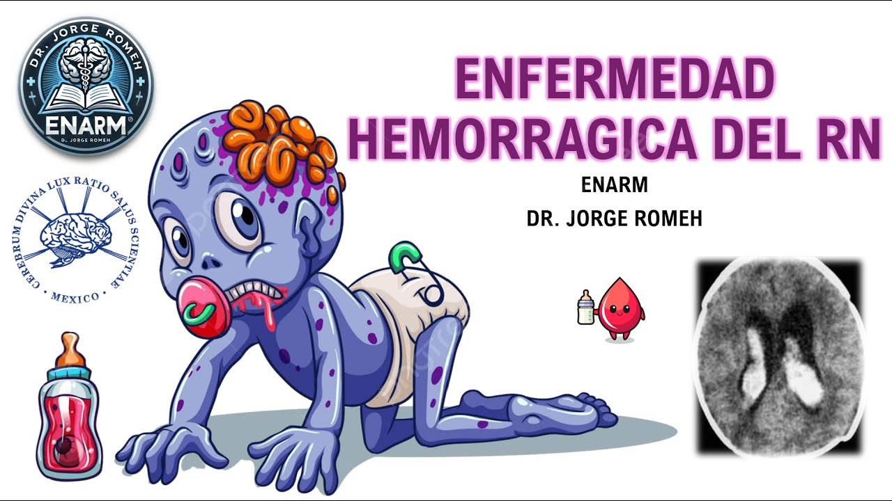 ENFERMEDAD HEMORRAGICA DEL RECIEN NACIDO - ENARM - TODO LO QUE DEBES SABER