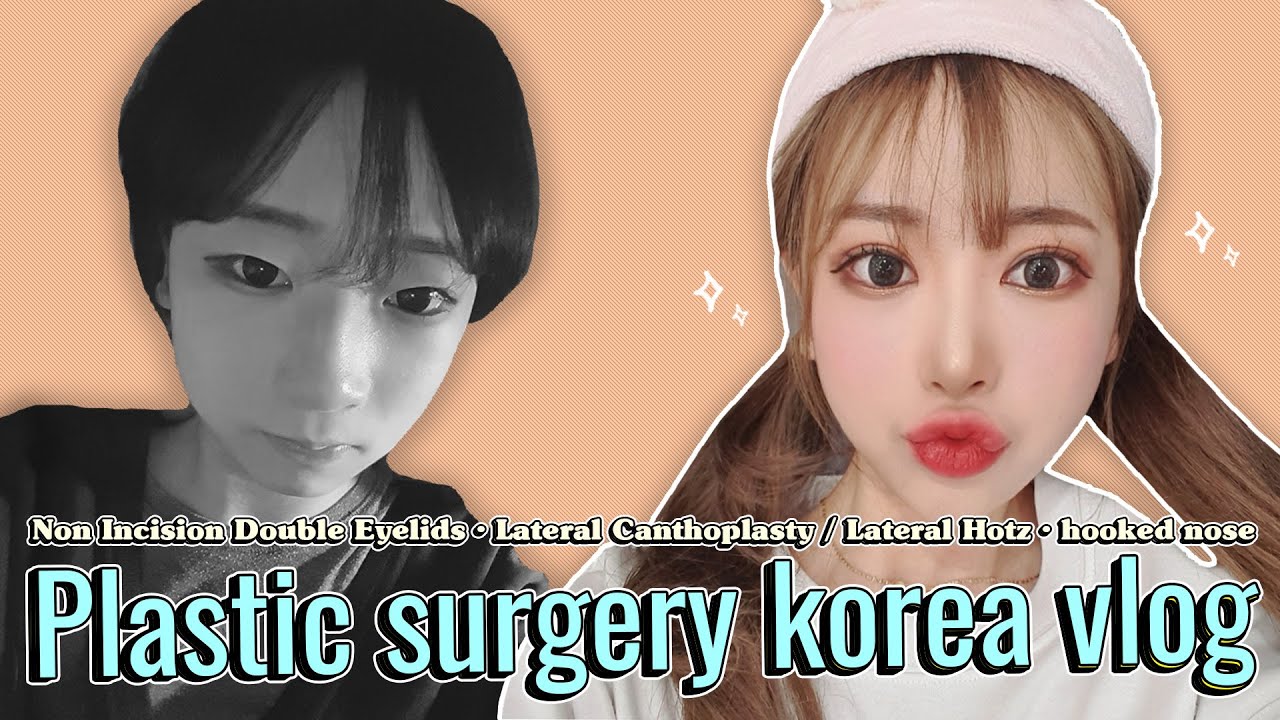 Plastic Surgery in Korea |  Double Eyelid Surgery, Asian Rhinoplasty Before and After