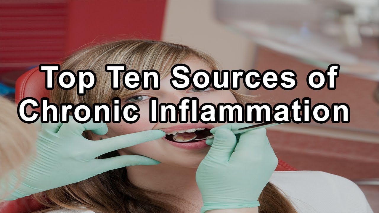 Top Ten Sources of Chronic Inflammation and Toxicity in the Mouth With Holistic Dentist