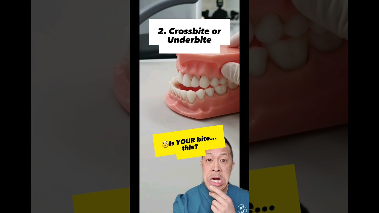 🤔Unveiling the Bite Types: Find out YOUR dominant Chomping Pattern #shorts #dentallan #bite #teeth