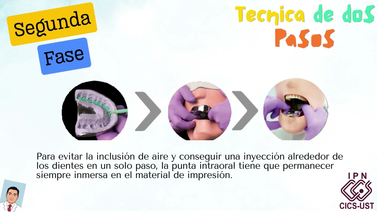 Tecnicas de toma de impresion con silicona por condensacion dental  y vaciado.