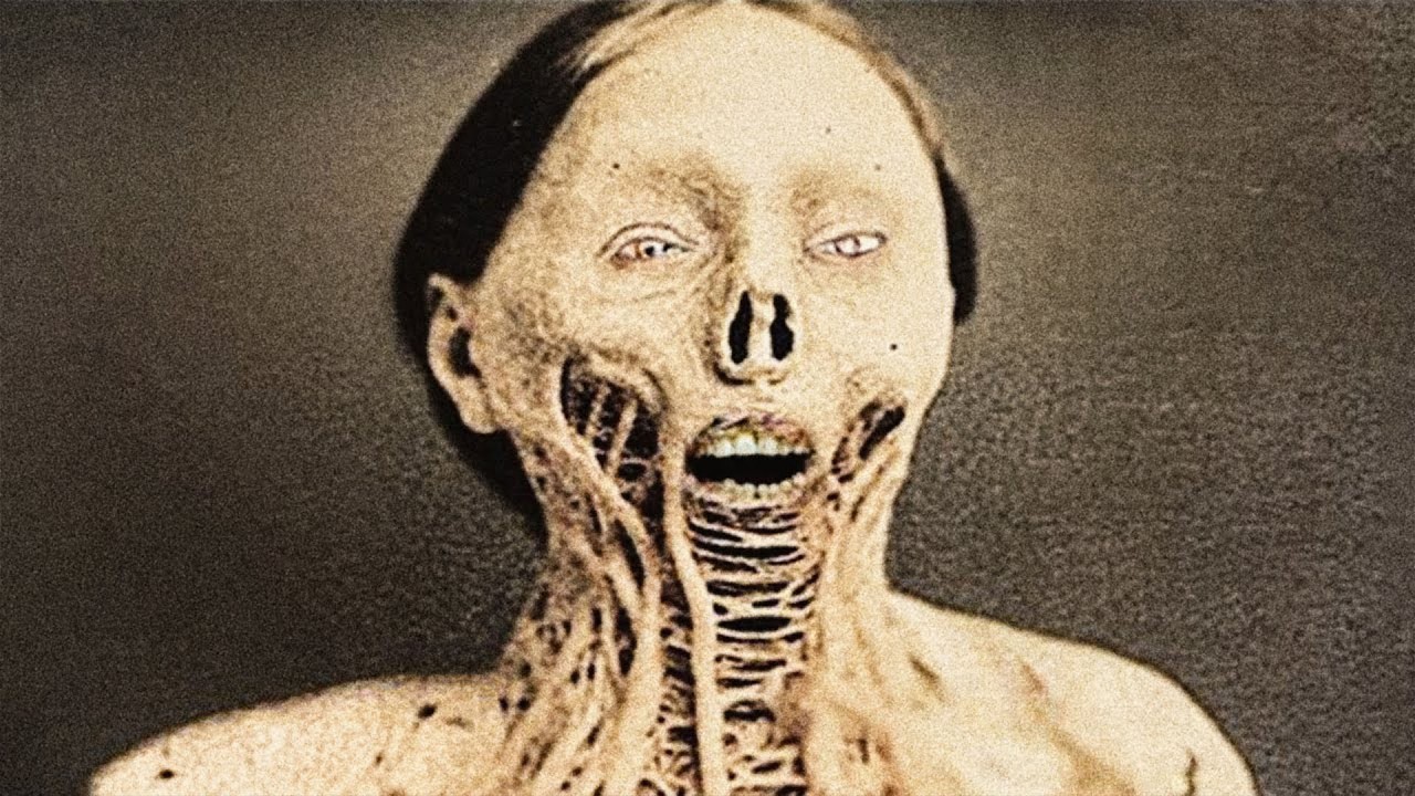 Terrifying Diseases From History That Still Haunt Us Today