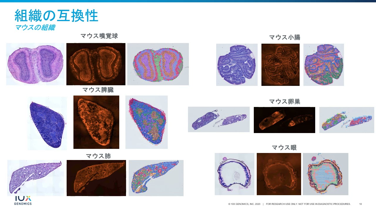 Visium空間的遺伝子発現ワークフロートレーニング
