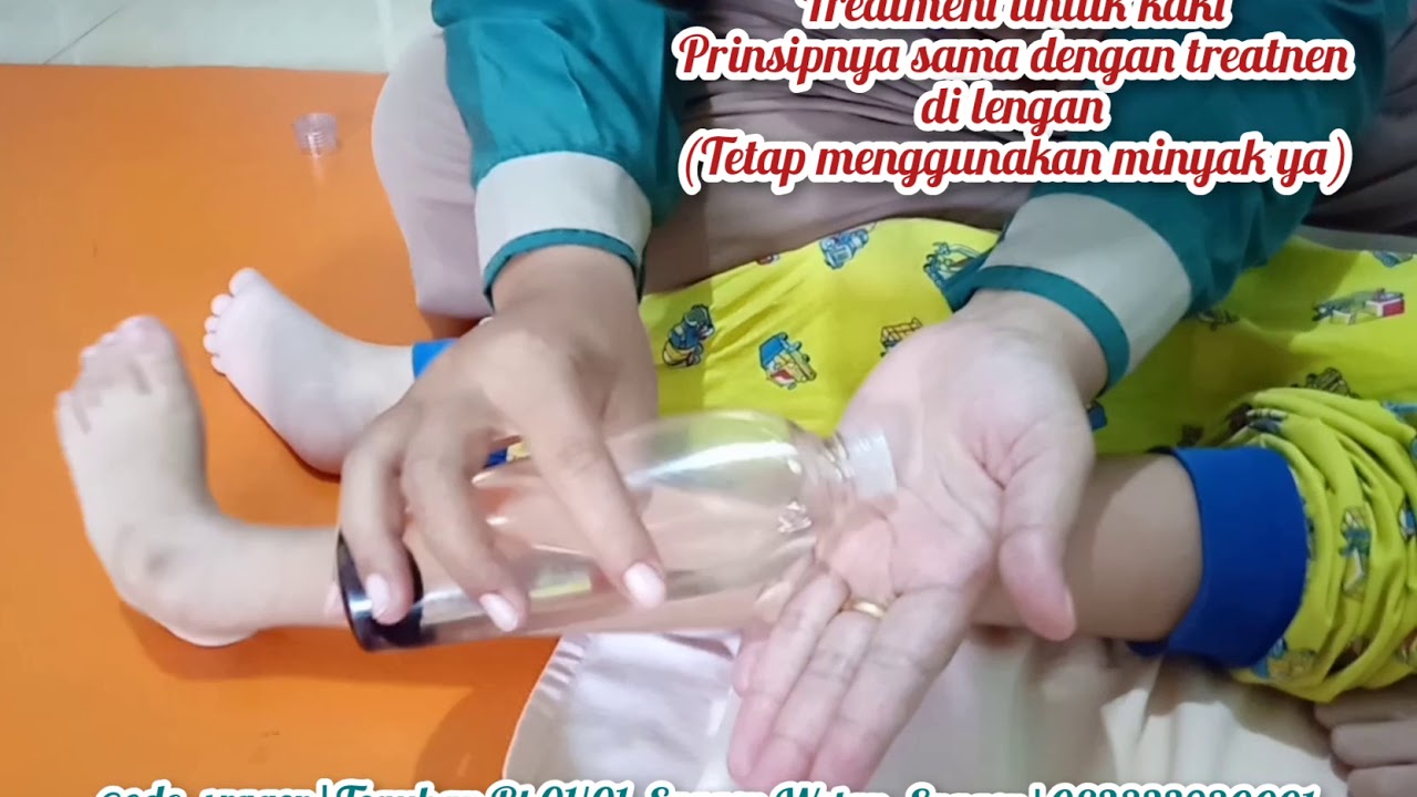 Mengurangi Spastisitas/Kekakuan pada Anak Cerebral Palsy | FISIOTERAPI