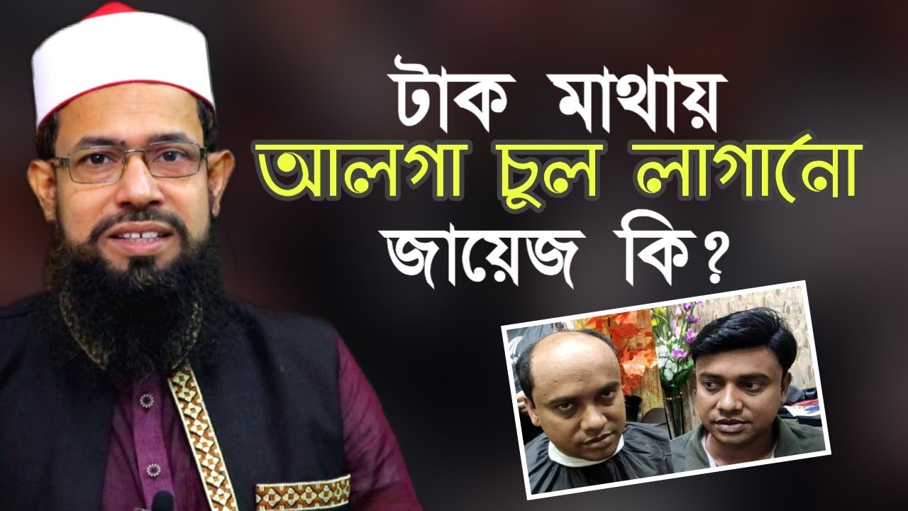 টাক মাথায় আলগা চুল লাগানো জায়েজ কি? Hair Replacement Golam Kabir Azhari Bangla Waz