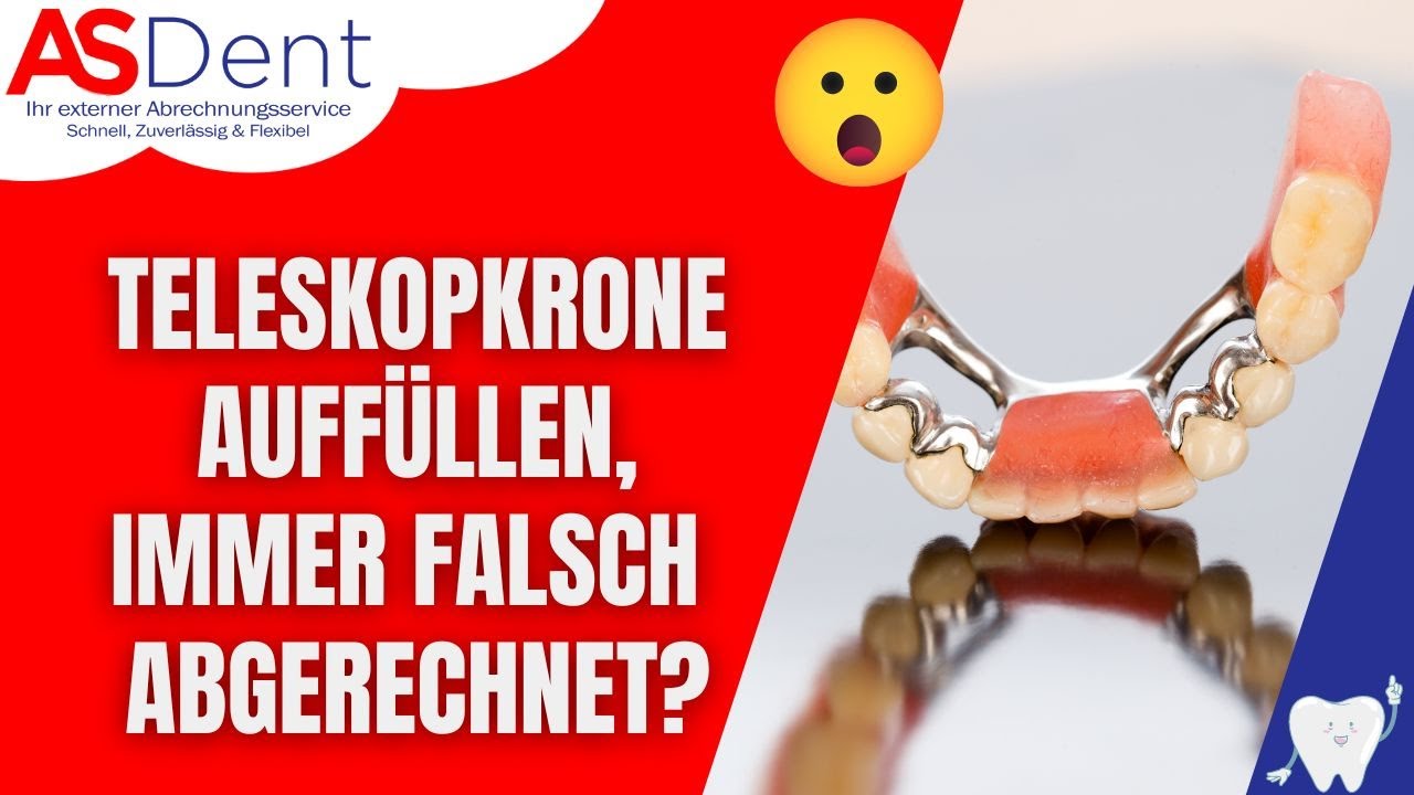 Sekundärteleskopkrone auffüllen korrekt abrechnen I Zahnärztliche Abrechnung