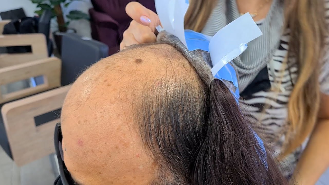 Como eu aplico a Prótese capilar injetada!