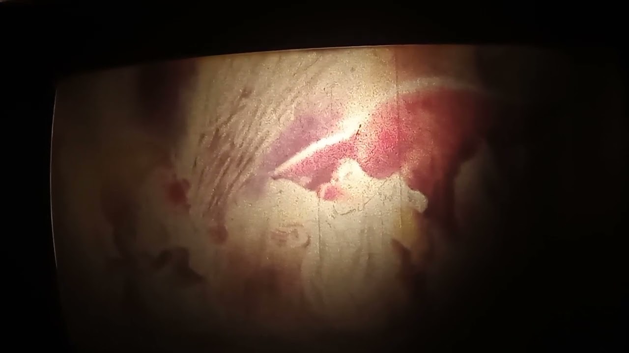 хербе большая шляпа 2 серия