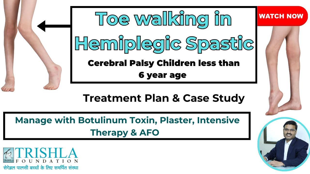 Toe Walking with Hemiplegic Spastic Cp in Early Age Children: Treatment Plan & Case Study