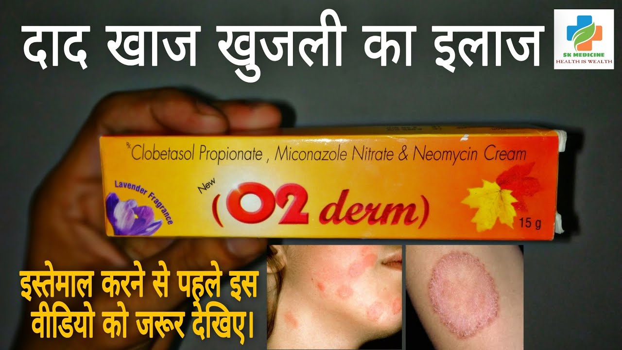 O2 Derm cream | दात खाज खुजली जड़ से खत्म | O2 Derm cream review in Hindi | fungal infections cream