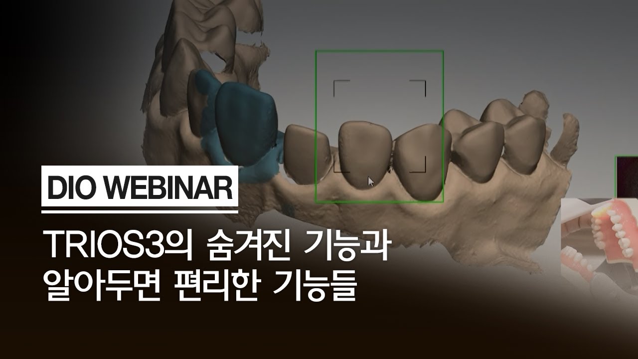 완전히 새로워진 구강 스캐너 Trios3의 숨겨진 기능