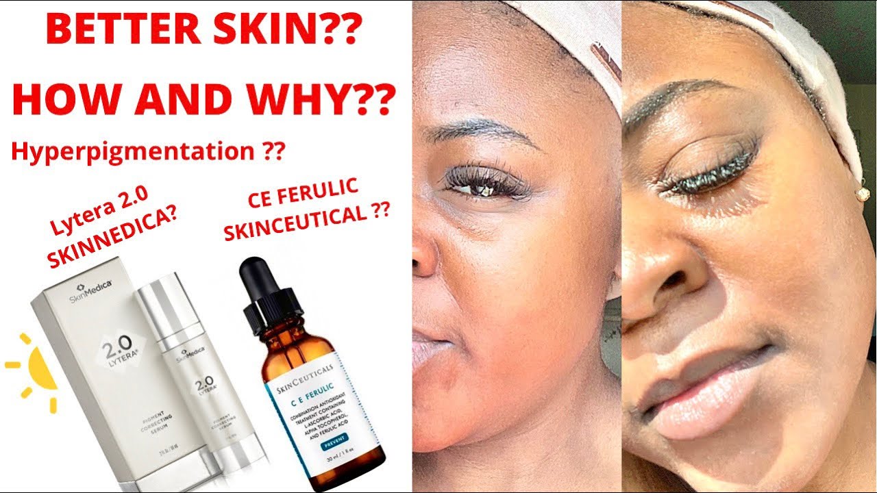 Why and How CE Ferulic from Skincuetical is giving me Better Skin