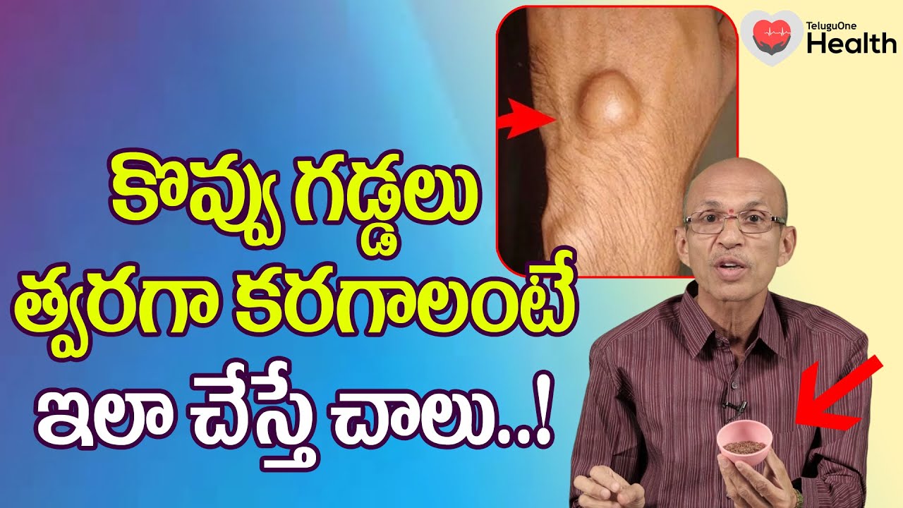 Kovvu Gaddalu | కొవ్వు గడ్డలు త్వరగా కరగాలంటే ఇలా చేయండి Dr. Ch Madhusudana Sarma | TeluguOne Health