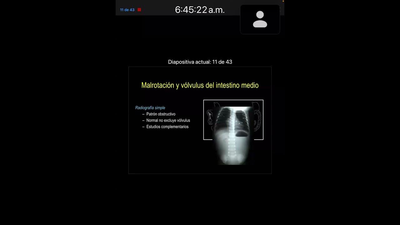 Utilidad de las imágenes diagnósticas en el niño que vomita