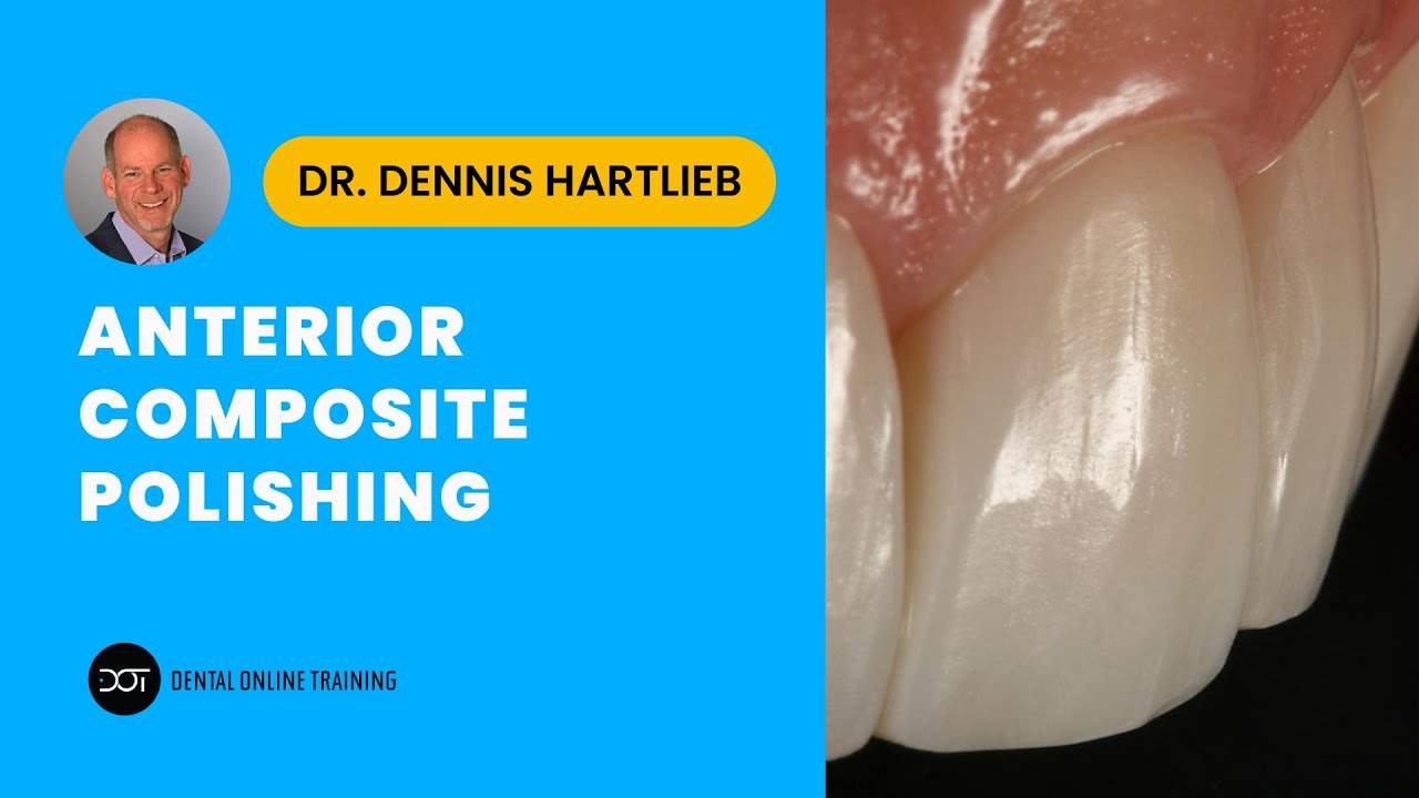 Anterior Composite Polishing | Dental Online Training