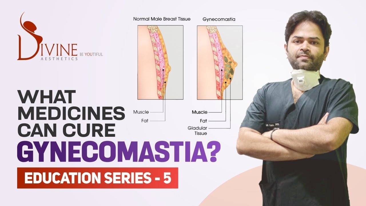 What Medicines Can Cure Gynecomastia? (Gynecomastia Education Series, Session 5)