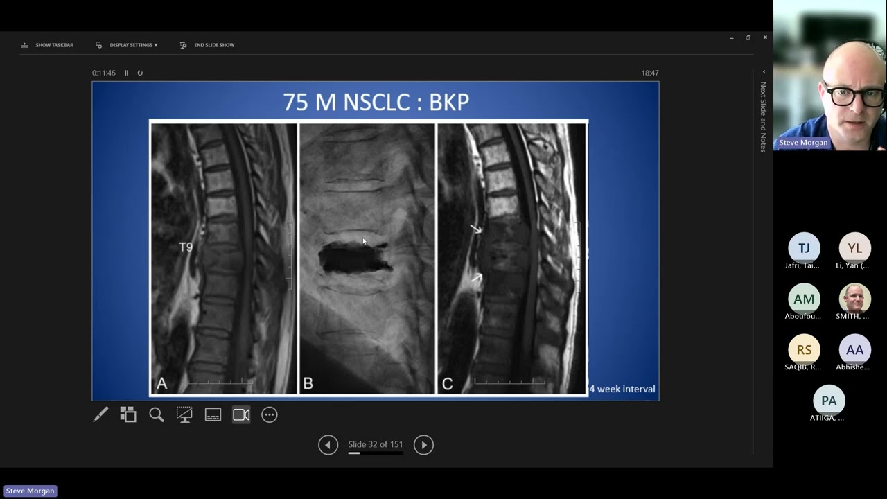 Spinal Intervention teaching