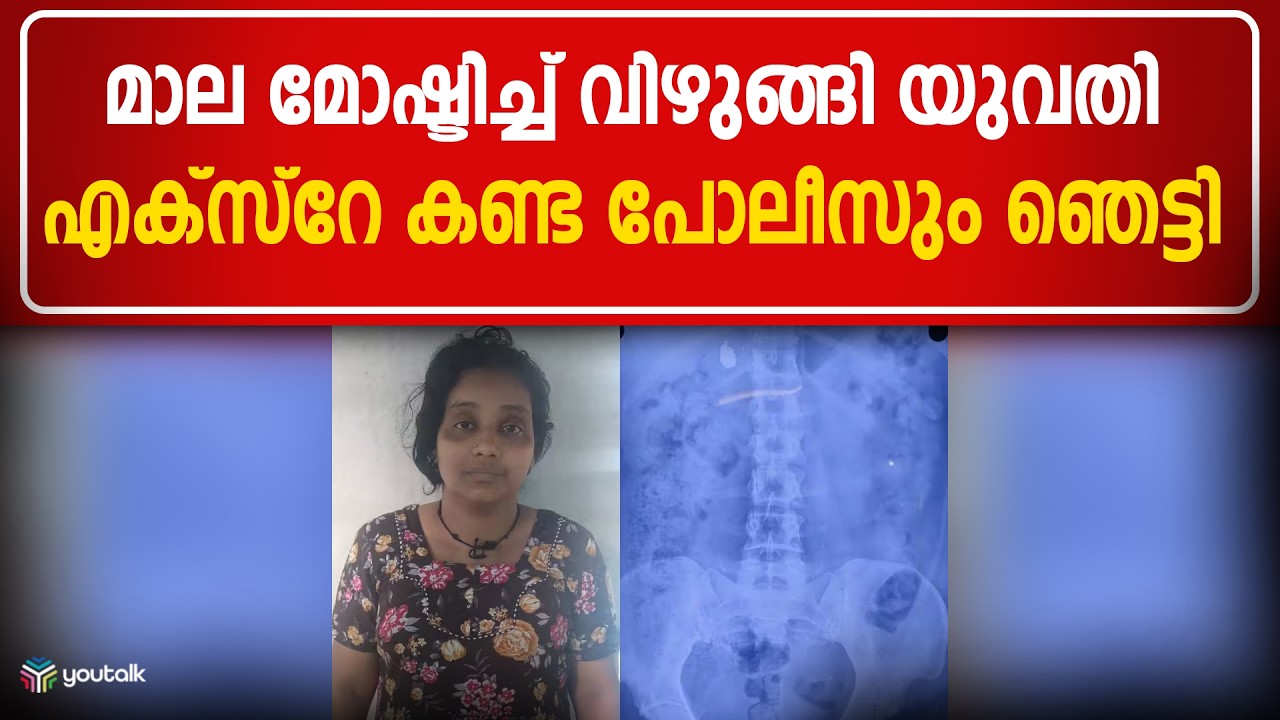തൊണ്ടിമുതൽ വയറ്റിൽ!! നിലമ്പൂരിലെ മാലക്കള്ളിയെ കുടുക്കിയത് എക്സ്‌റേ | Nilambur Theft