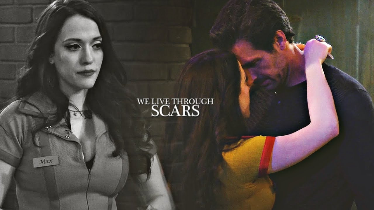 Max & Randy | Scars