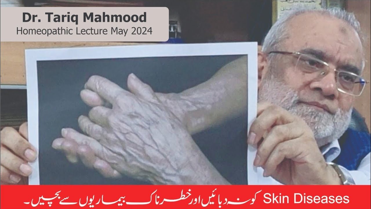 Dr.Tariq Mahmood Homoeopathic Lecture May 2024