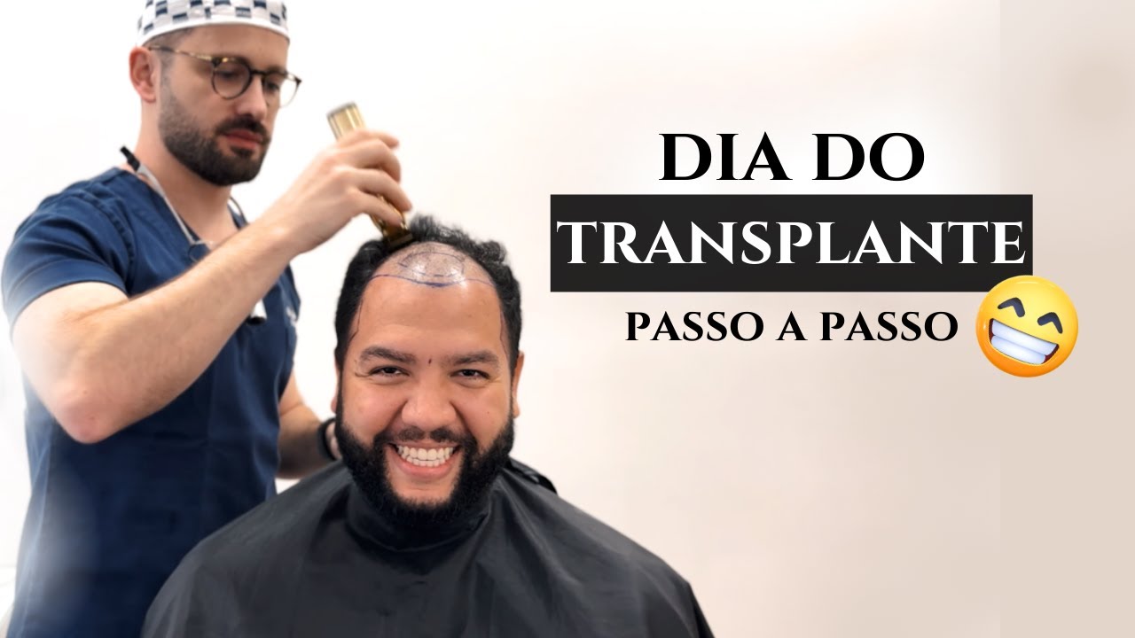 #vlog Dia Completo de Transplante Capilar na Pierezan