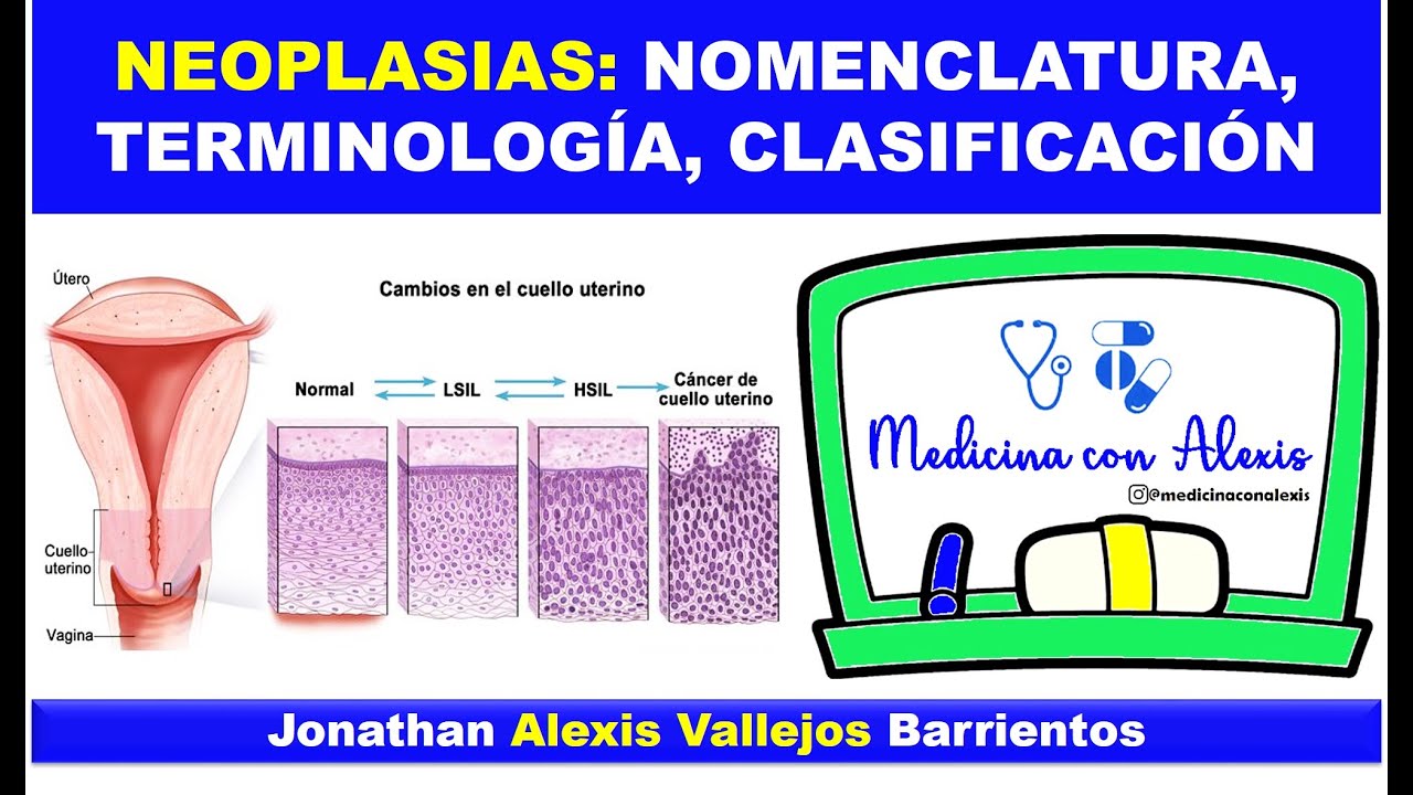 NEOPLASIAS: NOMENCLATURA - TERMINOLOGÍA - CLASIFICACIÓN