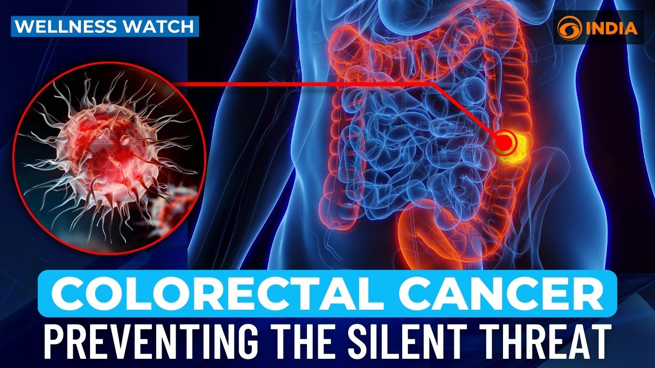 Colorectal Cancer: Preventing the silent threat | Wellness Watch