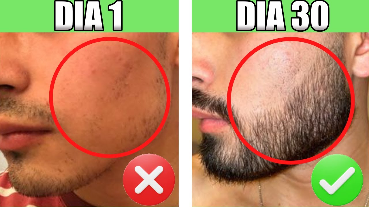 Como Fazer a Barba Crescer em Quem Não Tem