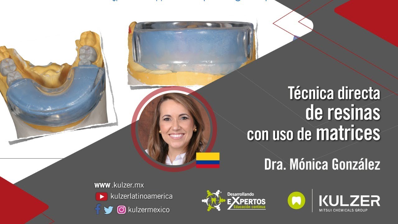 Desarrollando eXpertos -Técnica directa de resinas con uso de matrices