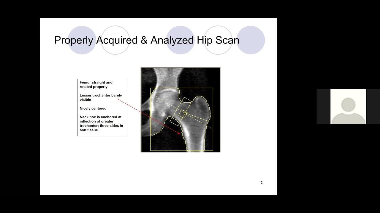 APO DXA Hologic Tech Training