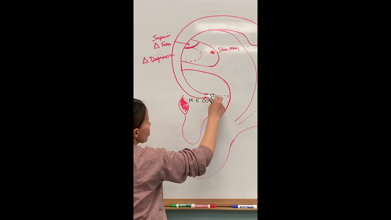 Class 2 Whiteboard Representations of Cavum and Cymba Concha