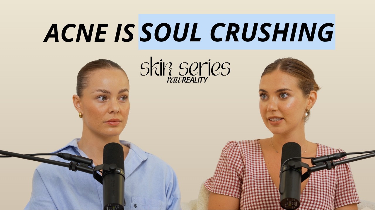 Skin Series ✨ Sophie Jayne and why she refused roaccutane